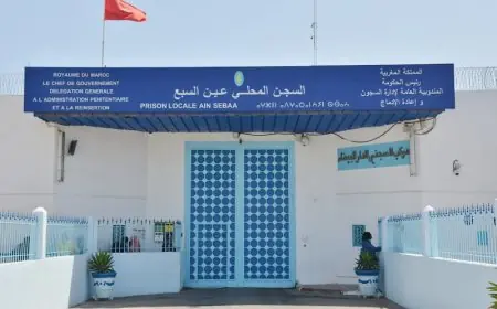 إدارة سجن عين السبع تكشف حقيقة وفاة سجين بمستشفى ابن رشد