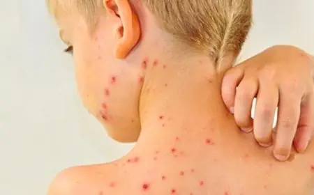 وزارة الصحة تتخذ إجراءات للوقاية من الحصبة بين تلاميذ تطوان