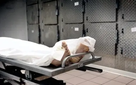 وفاة سائح بريطاني بسبب داء الكلب بعد تعرضه لخدش من كلب ضال في المغرب