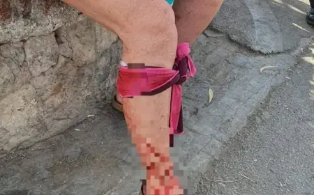 شفشاون.. عضة كلب ضال ترسل سائحة أجنبية للمستشفى وتعيد خطر هذه الظاهرة للواجهة