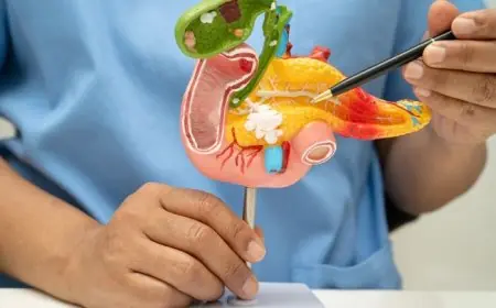 إنجاز طبي إسباني يفتح مساراً واعداً لعلاج سرطان البنكرياس