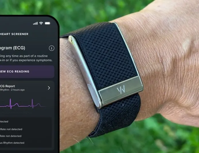 غوغل تستعد لإطلاق سوار ذكي بدون شاشة