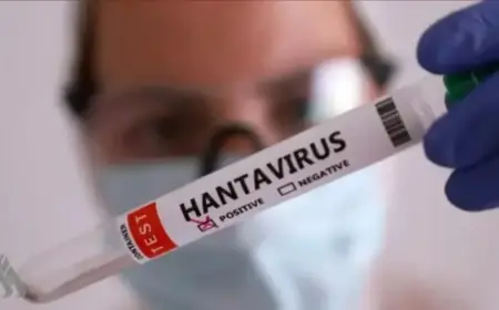 Canada : premier cas confirmé de virus Hanta enregistré ce samedi