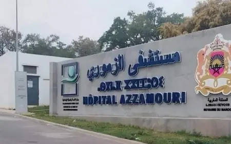 سابقة طبية بالقنيطرة.. مستشفى الزموري ينجح في استئصال ورم معقد لثمانينية