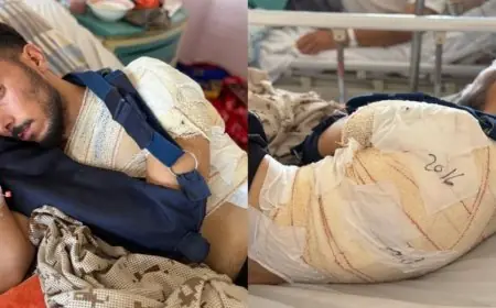 الكشف عن حقيقة صورة تظهر وضعية شخص بعد تداولها على أنها تعود لأحداث سبتة المحتلة